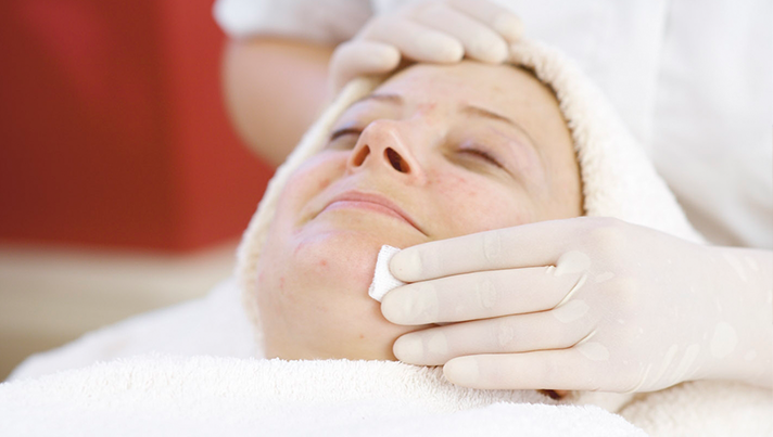 skin-peel